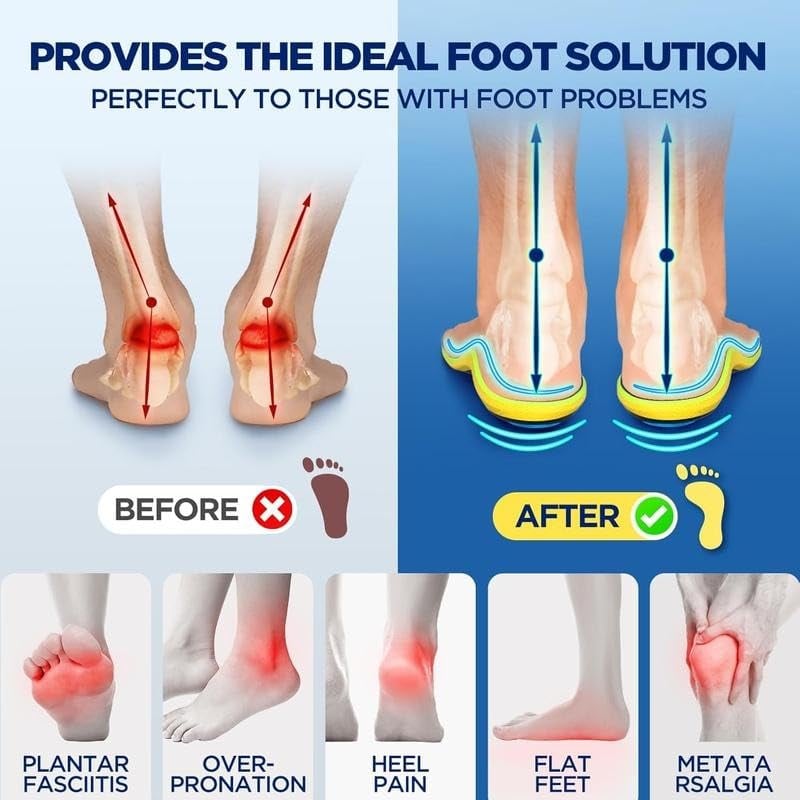 Last Day 49% OFF🔥 Running Insoles for Plantar Fasciitis