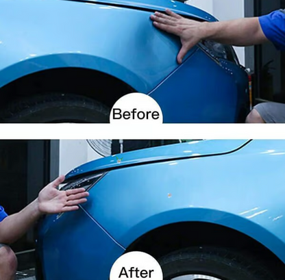 Last Day 49% OFF🔥Car Body Dents-Remover Puller Cups🚗