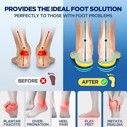 Last Day 49% OFF🔥 Running Insoles for Plantar Fasciitis